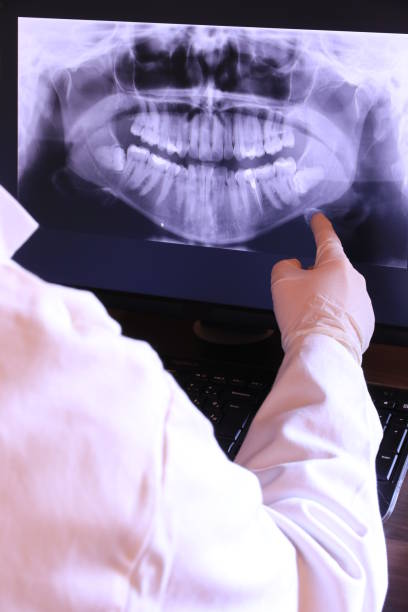 Best Emergency Wisdom Tooth Extraction in Martinsburg, PA