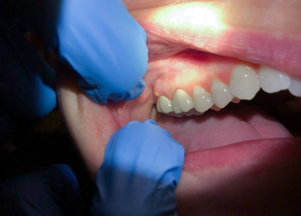 Best Emergency Treatment for Jaw Pain or Injury in Martinsburg, PA